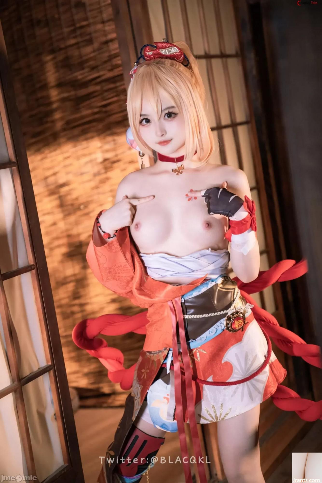 Blacqkl (白丽爱吃chocolate) cosplay Yoimiya – Genshin Impact (92P)